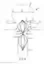 Fig. 08 - Vascular remodeling device