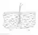 Fig. 01 - Surgical tunneling instrument with expandable section