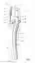 Fig. 02 - Guided osteotome