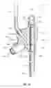 Fig. 46 - Blockage clearing devices, systems, and methods
