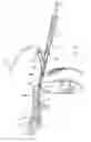 Fig. 01 - Increased axial load carrying sheathed irrigating balloon catheter