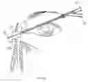 Fig. 06 - Increased axial load carrying sheathed irrigating balloon catheter