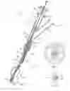 Fig. 08 - Increased axial load carrying sheathed irrigating balloon catheter