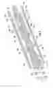 Fig. 06 - THROMBECTOMY CATHETER DEVICE