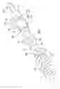 Fig. 07 - THROMBECTOMY CATHETER DEVICE