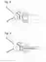 Fig. 04 - Surgical instrument
