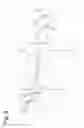 Fig. 08 - Surgical instrument