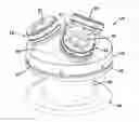 Fig. 01 - Surgical access device