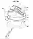 Fig. 03 - Surgical access device