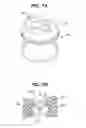 Fig. 16 - Surgical access device