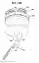 Fig. 33 - Surgical access device