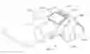 Fig. 01 - External adjustment device for distraction device