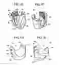 Fig. 04 - Articulating implant connectors and related methods
