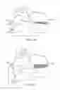 Fig. 04 - METHODS AND SYSTEMS FOR INCREASING THE BENDING STIFFNESS OF A SPINAL SEGMENT WITH ELONGATION LIMIT
