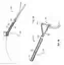 Fig. 02 - Apparatus and method for joint repair
