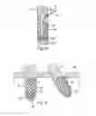 Fig. 09 - Device for producing an anchorage in human or animal tissue