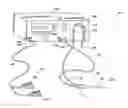 Fig. 01 - Flow blocking electrode