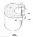 Fig. 08 - Flow blocking electrode