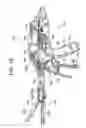 Fig. 06 - Methods and devices for controlling motorized surgical devices