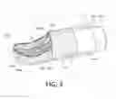 Fig. 04 - TISSUE RESECTING DEVICES AND METHODS