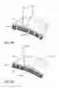 Fig. 07 - TISSUE RESECTING DEVICES AND METHODS