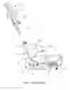 Fig. 02 - CATHETER WITH FLOATING CURVATURE