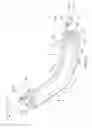 Fig. 05 - CATHETER WITH FLOATING CURVATURE