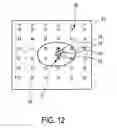Fig. 11 - SYSTEM SUPPORTING TREATMENT OF A SUBJECT