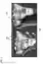 Fig. 07 - Reduction methods for aligning bone segments using customized jigs
