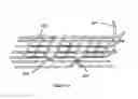 Fig. 07 - Electrode lead