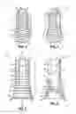 Fig. 04 - Multi-unit dental assembly with off-axis feature
