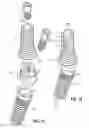 Fig. 09 - Multi-unit dental assembly with off-axis feature