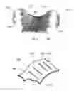 Fig. 04 - METHODS OF PRODUCING REMOVABLE ORAL DEVICES