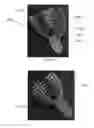 Fig. 06 - METHODS OF PRODUCING REMOVABLE ORAL DEVICES