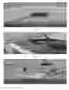 Fig. 06 - Dentures (false teeth) made permanent using vacuum suction