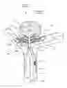 Fig. 01 - BLOOD FLOW DIVERSION DEVICE