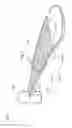 Fig. 06 - BLOOD FLOW DIVERSION DEVICE