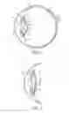 Fig. 02 - INTRAOCULAR LENS WITH SHAPE CHANGING CAPABILITY TO PROVIDE ENHANCED ACCOMODATION AND VISUAL ACUITY