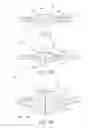 Fig. 04 - INTRAOCULAR LENS WITH SHAPE CHANGING CAPABILITY TO PROVIDE ENHANCED ACCOMODATION AND VISUAL ACUITY