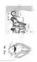 Fig. 16 - Prosthetic valve with leaflet connectors