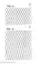 Fig. 04 - Expandable sheath for introducing an endovascular delivery device into a body