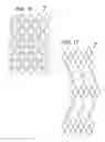 Fig. 09 - Expandable sheath for introducing an endovascular delivery device into a body