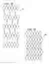 Fig. 10 - Expandable sheath for introducing an endovascular delivery device into a body