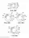 Fig. 16 - Expandable sheath for introducing an endovascular delivery device into a body