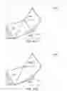 Fig. 09 - Fluid interface system for implants