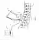 Fig. 03 - Surgical implant bending system and method