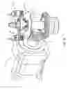 Fig. 18 - Surgical implant bending system and method
