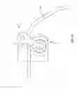 Fig. 33 - Surgical implant bending system and method