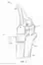 Fig. 02 - Elbow joint prostheses