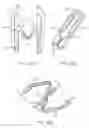 Fig. 27 - Methods and apparatus for implanting an interbody device
